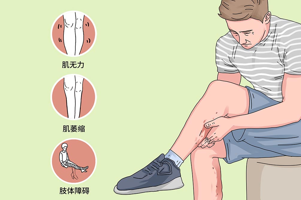 当你宅在家的时候，你知道你的身体有哪些变化吗？
